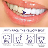 V34 Whitening Pen: Strong Bleaching Pen To Make Your Teeth Look Whiter In An Instant!