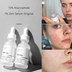 The Ordinary 30ML Niacinamide Serum with 10% Zinc & 1% Vitamin C: Whitening Essence for Facial Acne